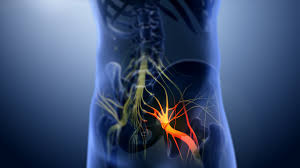 Sciatica Chiropractic Treatment