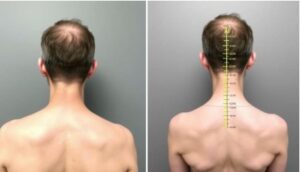 Your Body After a Chiropractor